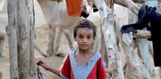 Yemenin lapset kärsivät nälänhädästä.