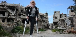 jeune fille amputée avec béquille dans la ville de Homs en Syrie; Le conflit dure depuis 11 ans