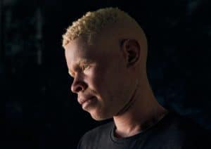 Charles, 16 ans, RDC. Charles vivait avec sa mère et son père, mais a été contraint de se déplacer car persécuté en tant que personne atteinte d’albinisme.* © Paddy Dowling