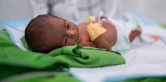 Bambino prematuro in un ospedale in Yemen. Credit: UNICEF/Ali Bahumaid
