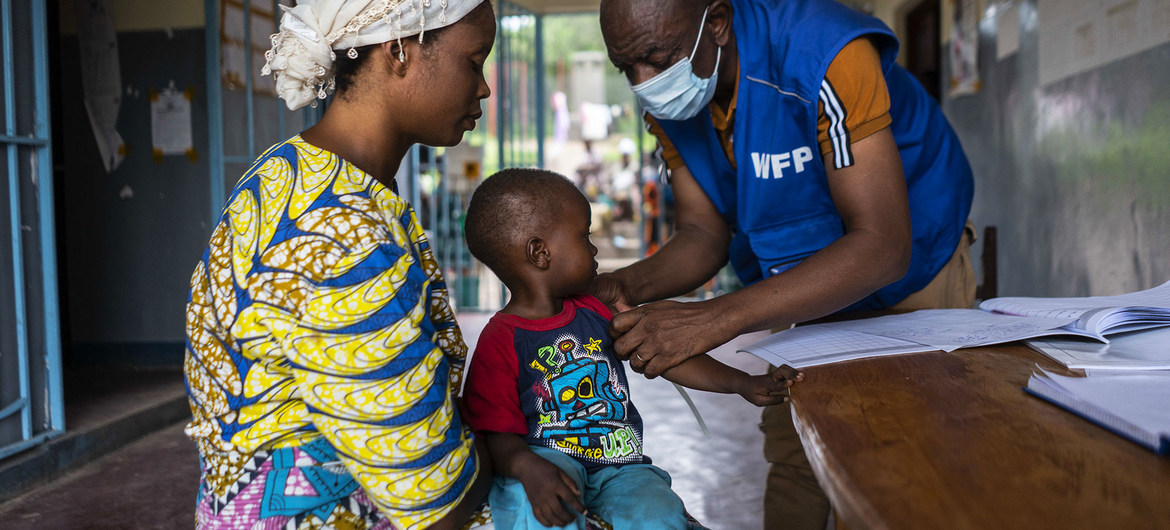 Criança com desnutrição sendo observada em Kalemie, na República Democrática do Congo