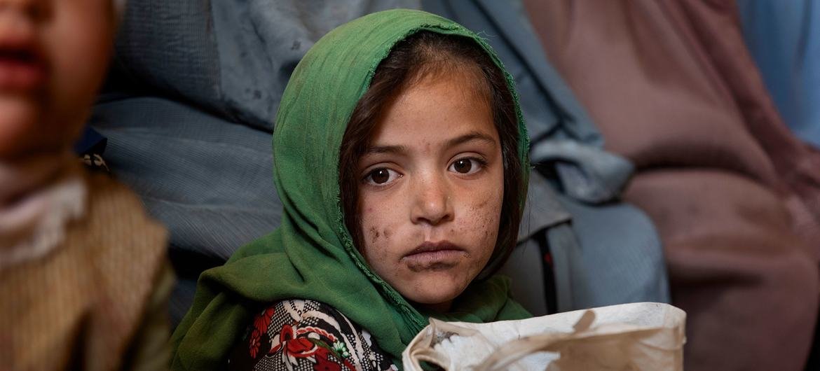 Menina espera para ser atendida em clínica apoiada pelo Unicef em Kandahar, Afeganistão. 