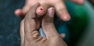 Ett finger i närbild med en droppe blod