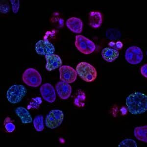 En vetenskaplig bild av cancerceller