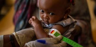 Ett litet barn som lider av undernäring